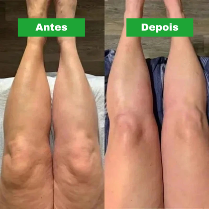 LYMFACIO® Gotas para Drenagem Linfática..